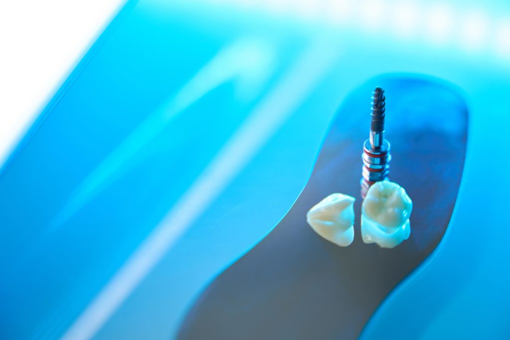Tratamiento de periimplantitis