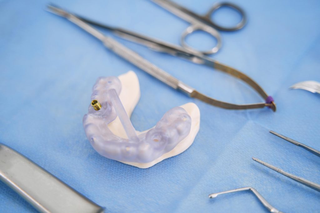 Rehabilitación oral sobre implantes