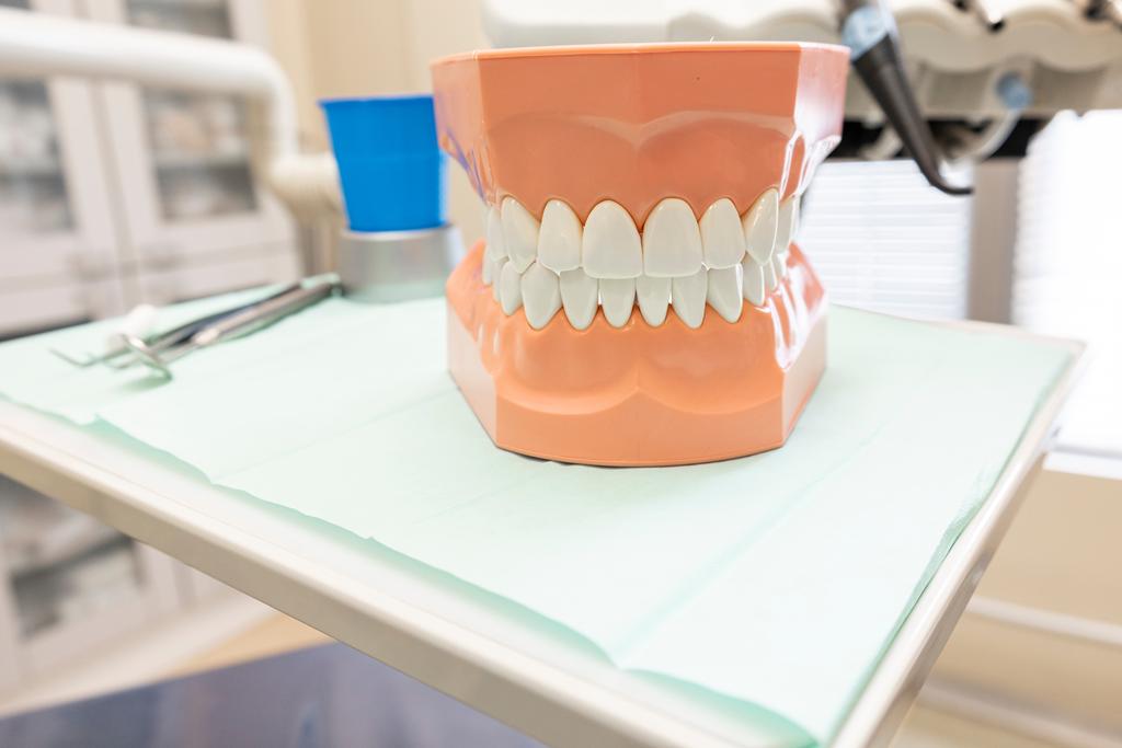 Modelo dental utilizado para planificar tratamientos de implantología y rehabilitación oral en Castellón.