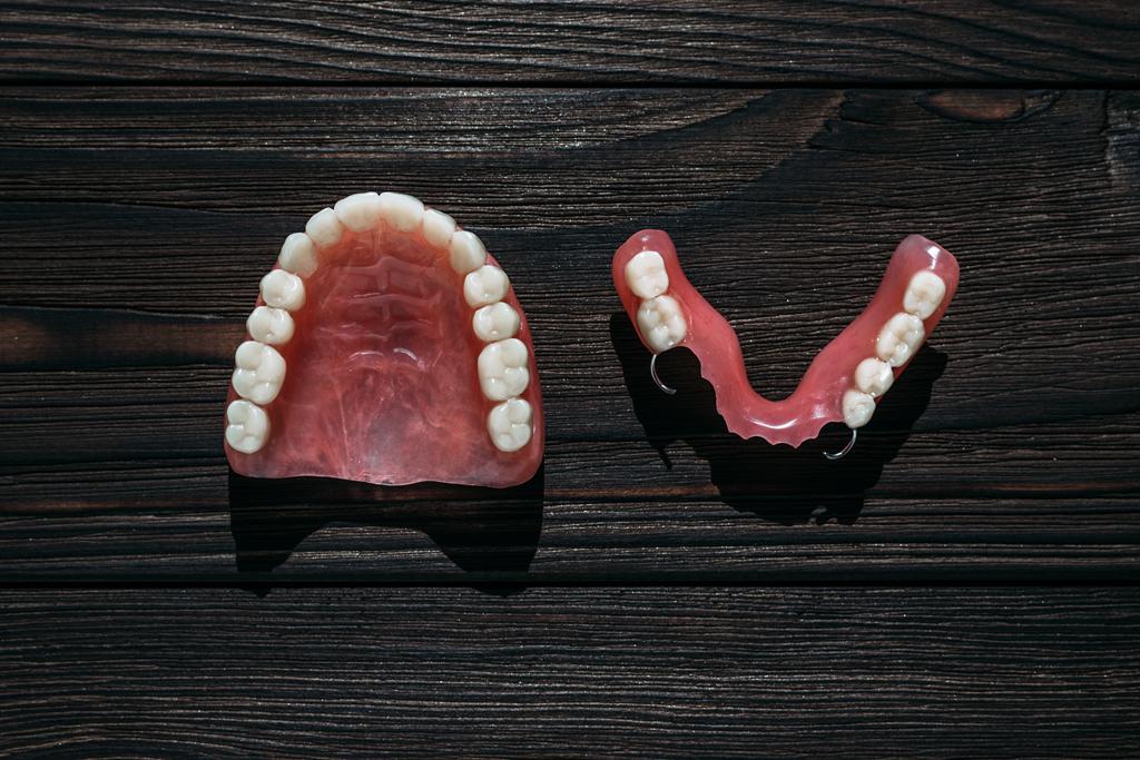 Prótesis dentales removibles utilizadas para reemplazar varias piezas dentales y recuperar la funcionalidad de la sonrisa.