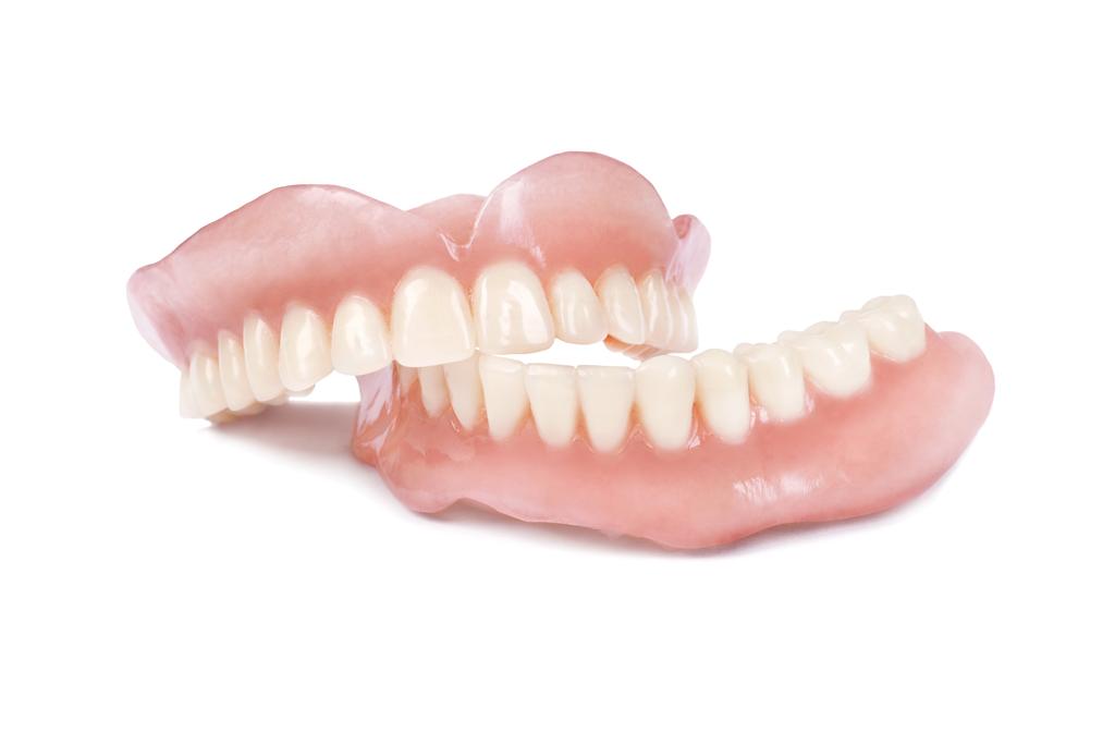Diferencias entre implantes dentales y prótesis removibles