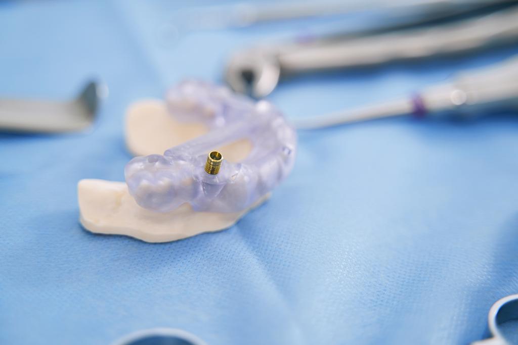 Guía quirúrgica utilizada para la colocación precisa de implantes dentales en tratamientos de implantología avanzada.